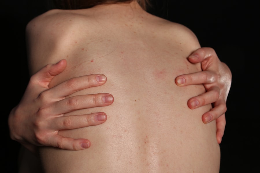 Mobilizacja blizny cesarskiej: skuteczne metody pielęgnacji 2 Cesarean scar mobilization